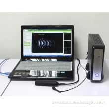ophthalmic equipment AB scanner